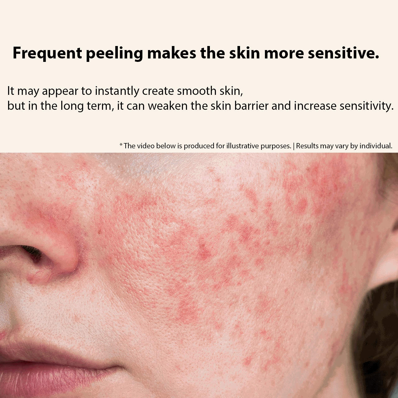 [ Vemontes ] Vemontes Orthomin C Vitaplant System | Brightening & Renewal Care