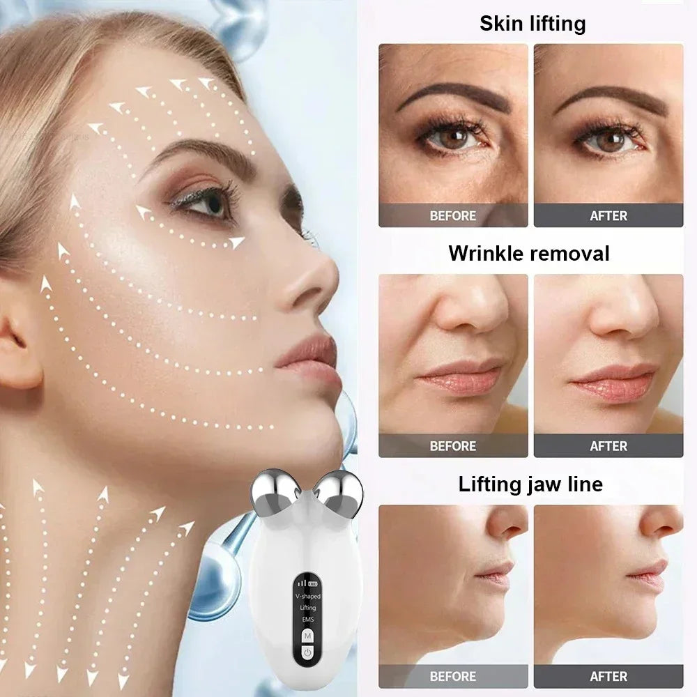 Facial Massager Microcurrent Roller EMS Device For Face Lifting Skin Tighten Rejuvenation Chin Remover Anti Wrikle Double care