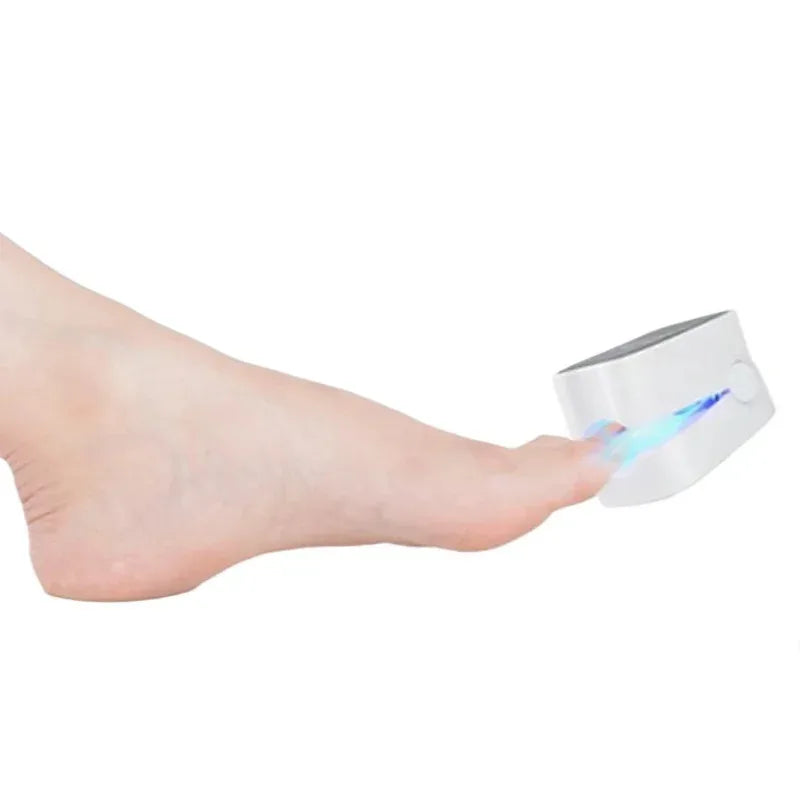 Nail Fungus Cleaning Light Device for Onychomycosis USB Charge Nail Fungus Laser  Infrared Blue Light NailSalon