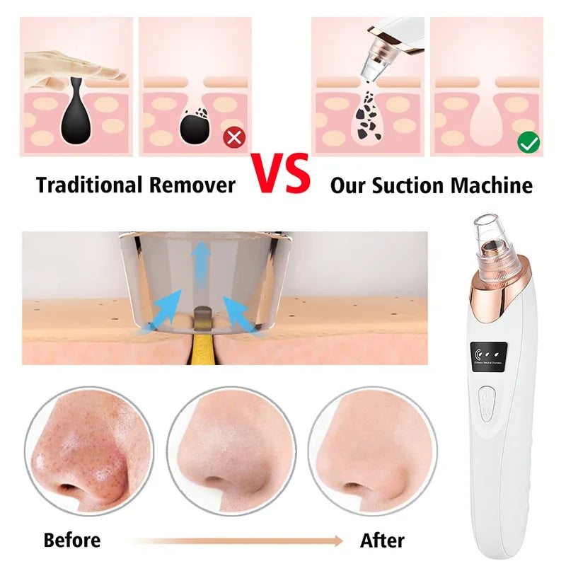 Electric Blackhead Remover Face Deep Cleansing Pore Beauty Machine Dead Skin Remover Face Vacuum Blackhead Removal Skin Care USB