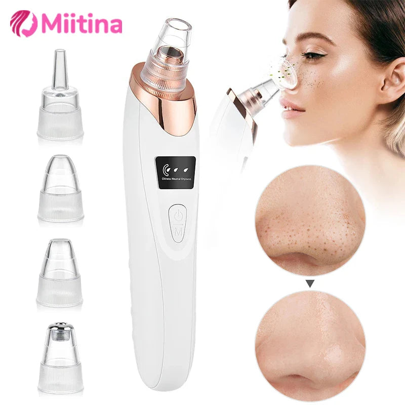 Electric Blackhead Remover Face Deep Cleansing Pore Beauty Machine Dead Skin Remover Face Vacuum Blackhead Removal Skin Care USB